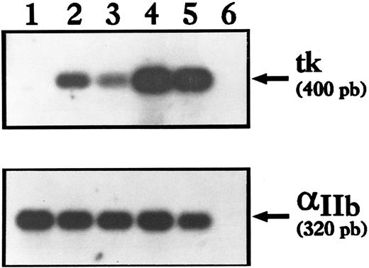 Fig. 2. RT-PCR analysis of the expression of the tk gene driven by the αIIb promoter. A 5-μL aliquot of the cDNA derived from BM cells was amplified with a pair of specific primers for 30 cycles. One fifth of the product was applied to 1.5% agarose gel for electrophoresis. Panels show the results of Southern hybridization of RT-PCR products with the internal probe of each gene. Each experiment was checked for reproducibility. Lane 1, nontransgenic mouse; lane 2, HαIIbtk (1 copy); lane 3, MαIIbtk (1 copy); lane 4, MαIIbtk (3 copies); lane 5, MαIIbtk (4 copies); lane 6, PCR performed without RT as control against contamination. Amplification of endogenous αIIb transcripts were performed with αIIb-specific oligonucleotides on the same samples.