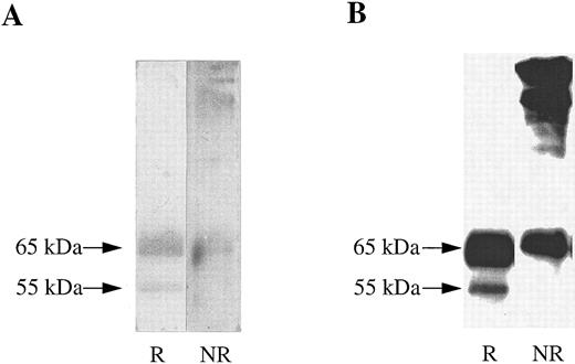 Fig. 3. Soluble βc protein was purified from conditioned medium from CHO transfectants. Soluble purified βc protein was run under reducing (R) or nonreducing (NR) conditions on 10% SDS-PAGE and either (A) silver stained or (B) subjected to Western transfer and immunoblotted with anti-βc antibody (1C1).