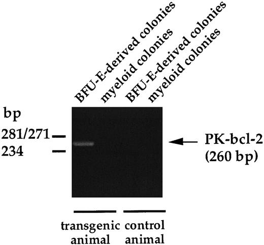 Fig. 4. RT-PCR analysis of hybrid PK-bcl-2 transcripts on hematopoietic colonies. Granulocytic and BFU-E–derived colonies were individually plucked from the methylcellulose under direct microscopic visualization 7 days after plating, total RNA of each sample was extracted, and used for RT-PCR amplification. The PK-bcl–2-specific amplified fragment is 260 bp long.