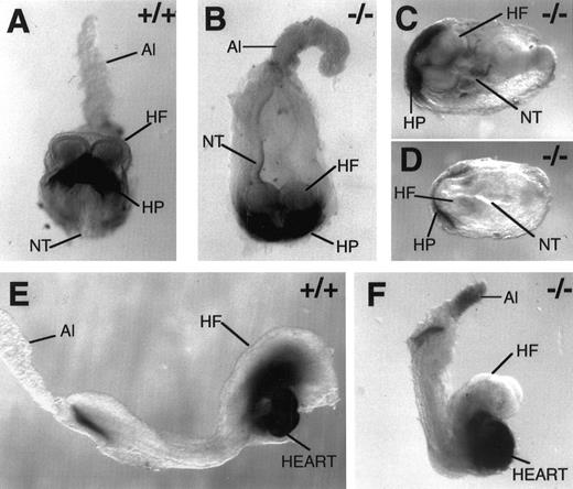 Fig. 2. Myocardial specification, but not heart tube morphogenesis, is normal in the absence of FNs. Whole-mount immunohistochemistry with antibody MF-20 to mark myosin-positive cells in wild-type E 8.0 (A), FN.null-/- E 8.0 (B), FN.null-/- more severe class at E 8.5 (C and D), wild-type E 8.5 (E), and FN.null-/- less severe class at E 8.5 (F) mouse embryos. Note that myosin-positive cells are situated normally within the mutant embryos, even when no primitive heart is formed. In the mutant embryos in which a heart is formed, myosin-positive cells consistently display abnormal heart morphogenesis. HP, heart primordium; NT, neural tube; HF, head fold; Al, allantois.