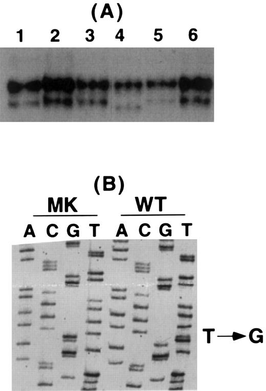 Fig. 2. Analysis of the patient's β3 gene. (A) SSCP analysis of β3 exon 4 in a normal control (lane 1), four unrelated thrombasthenic patients (lanes 2, 3, 5, and 6), and the patient (lane 4). The patient's lower band migrated faster than any of the other studied samples. (B) Sequence analysis of wild-type (WT) and the patient's (MK) DNA for β3 exon 4 showing a single T → G substitution in this exon.