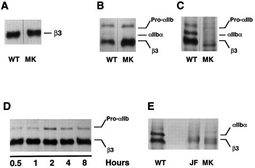 Fig. 3. Expression of β3 containing the Leu117 → Trp substitution in COS-1 cells. Wild-type (WT) and mutant (MK) β3 were expressed in COS-1, either alone or with αIIb. Cells were then either metabolically labeled with 35S-methionine or surface labeled with biotin-labeled proteins were immunoprecipitated by the antibodies indicated below and examined by SDS-polyacrylamide gel electrophoresis. (A) Wild-type and mutant β3 were expressed alone in COS-1 cells and immunoprecipitated from cells labeled with 35S-methionine using the β3-specific MoAb SSA6. (B and C) COS-1 cells were cotransfected with αIIb and either wild-type or mutant β3. After labeling the cells with 35S-methionine, αIIb-β3 was immunoprecipitated using the β3-specific MoAb SSA6 (B) or the heterodimer-specific MoAb A2A9 (C). (D) The cells were treated as in (B), but were pulse-chased for the various time intervals indicated. (E) The surface of COS-1 cells cotransfected with αIIb and either wild-type or mutant β3 was biotin labeled and immunoprecipitated using SSA6. WT is the wild-type complex, MK refers to αIIb-β3Leu117 → Trp complexes, and JF refers to αIIbGly273 → Asp-β3 complexes. Pro-αIIb corresponds to the single-chain αIIb precursor; αIIb-α corresponds to the αIIb heavy chain.