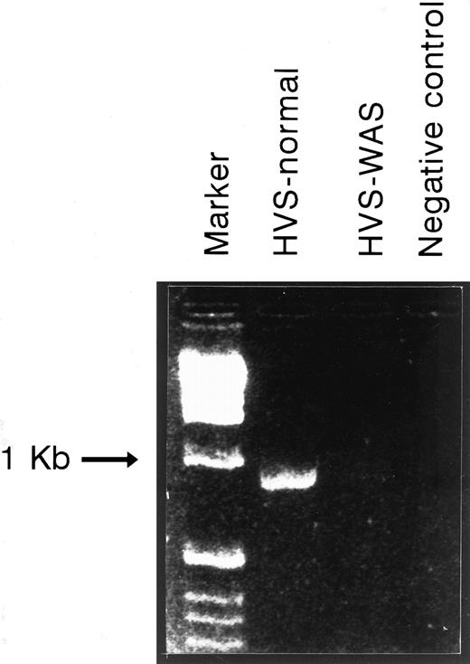 Fig. 2. WASP mRNA expression of HVS-Normal (HVS-N8) and HVS-WAS (HVS-WAS1) immortalized T-cell lines as detected by RT-PCR. Equal amounts of total RNA extracted from indicated cell lines were reverse-transcribed as detailed in the Materials and Methods. cDNAs were amplified by PCR using a pair of primers spanning WASP sequence nucleotides 20-39 (forward) and 980-961 (reverse). Amplification of HVS-Normal cells yields the expected fragment of 900 bp, whereas no equivalent band is detected in the HVS-WAS1 cells. In the last lane, the PCR-negative control (no template) was loaded.