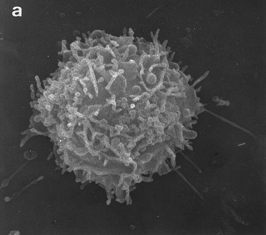 Fig. 4. SEM of HVS-Normal (HVS-N8) T cells. Random individual cells of an HVS-immortalized T-cell line derived from a normal individual. Cells are homogeneous in size and morphology, displaying dense projections of surface microvilli that are typical of normal peripheral blood lymphocytes and allospecific normal T-cell lines. (Original magnification × 8,000.)