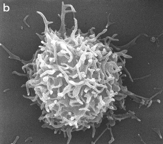 Fig. 4. SEM of HVS-Normal (HVS-N8) T cells. Random individual cells of an HVS-immortalized T-cell line derived from a normal individual. Cells are homogeneous in size and morphology, displaying dense projections of surface microvilli that are typical of normal peripheral blood lymphocytes and allospecific normal T-cell lines. (Original magnification × 8,000.)