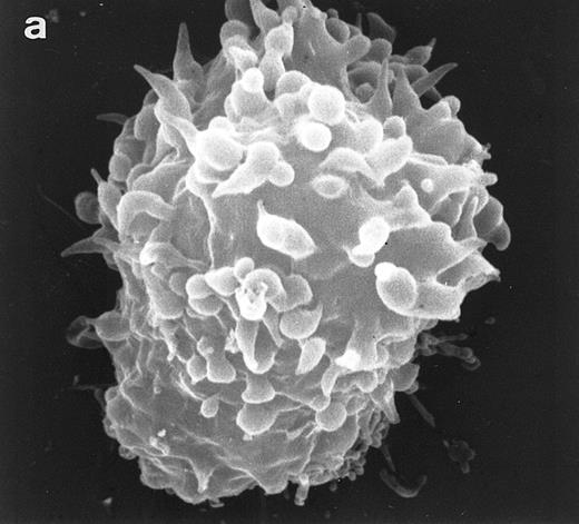 Fig. 5. Scanning electron micrographs of HVS-immortalized T cells from a WAS patient (HVS-WAS1). The WAS T-cell lines are heterogeneous in size and morphology, showing all cells' conspicuous abnormalities. Cells with lamellar or bulbous morphology are represented in (a) and (b). Cells with elongated and aberrant shapes are depicted in (c), (d), and (e). (Original magnification × 8,000.)