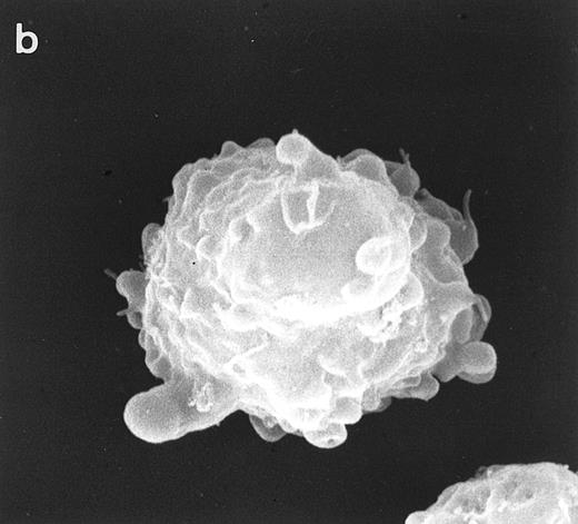 Fig. 5. Scanning electron micrographs of HVS-immortalized T cells from a WAS patient (HVS-WAS1). The WAS T-cell lines are heterogeneous in size and morphology, showing all cells' conspicuous abnormalities. Cells with lamellar or bulbous morphology are represented in (a) and (b). Cells with elongated and aberrant shapes are depicted in (c), (d), and (e). (Original magnification × 8,000.)