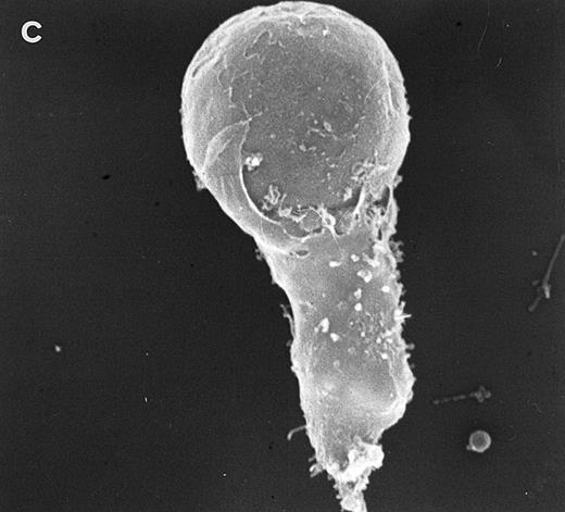 Fig. 5. Scanning electron micrographs of HVS-immortalized T cells from a WAS patient (HVS-WAS1). The WAS T-cell lines are heterogeneous in size and morphology, showing all cells' conspicuous abnormalities. Cells with lamellar or bulbous morphology are represented in (a) and (b). Cells with elongated and aberrant shapes are depicted in (c), (d), and (e). (Original magnification × 8,000.)