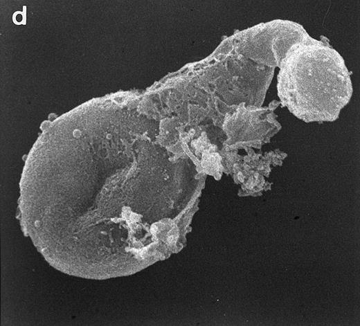 Fig. 5. Scanning electron micrographs of HVS-immortalized T cells from a WAS patient (HVS-WAS1). The WAS T-cell lines are heterogeneous in size and morphology, showing all cells' conspicuous abnormalities. Cells with lamellar or bulbous morphology are represented in (a) and (b). Cells with elongated and aberrant shapes are depicted in (c), (d), and (e). (Original magnification × 8,000.)