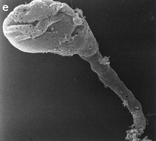 Fig. 5. Scanning electron micrographs of HVS-immortalized T cells from a WAS patient (HVS-WAS1). The WAS T-cell lines are heterogeneous in size and morphology, showing all cells' conspicuous abnormalities. Cells with lamellar or bulbous morphology are represented in (a) and (b). Cells with elongated and aberrant shapes are depicted in (c), (d), and (e). (Original magnification × 8,000.)