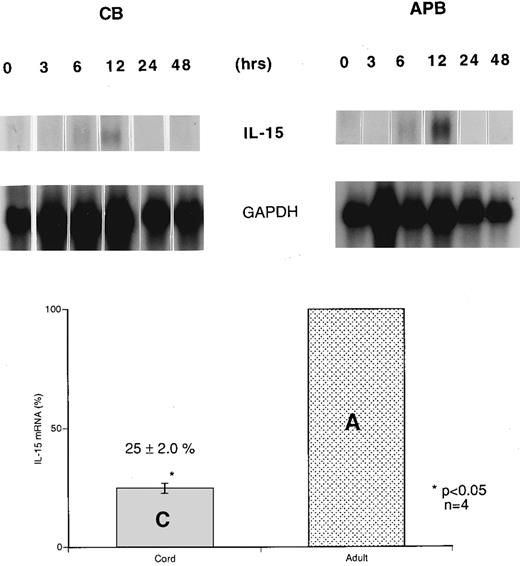 Fig. 1. Time course of induction of IL-15 mRNA expression in cord (CB) and adult (APB) MNCs. CB and APB MNCs were isolated, cultured in RPMI, and stimulated with 10 μg/mL LPS for 0, 3, 6, 12, 24, and 48 hours. Cells were harvested and poly (A)+ RNA samples were analyzed by Northern blot analysis of IL-15 mRNA (1.5 kb). Results shown are representative of three different CB and APB RNA blot hybridizations, normalized to GAPDH signal. The lower panel bar graph represents comparative IL-15 mRNA expression from LPS-stimulated (12 hours) CB and APB MNCs. Four different CB and APB samples were analyzed after 12 hours of LPS stimulation (10 μg/mL) for IL-15 mRNA expression by Northern blot analysis. The amount of IL-15 mRNA was expressed as a percentage, setting the amount of APB mRNA equal to 100% (APB v CB, 100% v 25% ± 2.0%, P < .05, n = 4).