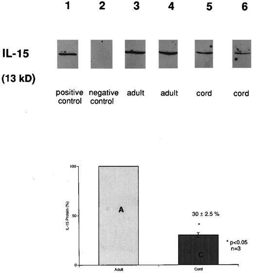 Fig. 2. Detection of IL-15 in stimulated cord (CB) and adult (APB) monocytes. Immunoblot analysis of LPS (12 hours) stimulated CB and APB monocytes using anti–huIL-15 goat antibody. Equal amounts of protein (20 μg) were loaded per lane. Before loading, quantitation of total protein from each sample was performed in duplicate, twice using BCA protein assay. Lane 1, rhIL-15; lane 2, adhered monocytes; lanes 3 and 4, LPS-stimulated adult monocytes; lanes 5 and 6, LPS-stimulated cord monocytes. The lower panel bar graph represents comparative IL-15 protein production from three different LPS-stimulated (12 hours) CB and APB monocytes. The amount of IL-15 protein was expressed as a percentage, setting the amount of APB level equal to 100% (APB v CB, 100% v 30% ± 2.5%, P < .05, n = 3).