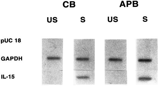 Fig. 3. Nuclear run-on analyses of IL-15 transcription in cord (CB) versus adult (APB) MNCs stimulated with LPS (10 μg/mL for 12 hours). Equivalent amounts of radioactive labeled RNA were hybridized to filters containing the indicated target DNA. Results shown are representative of three different experiments. US, unstimulated; S, stimulated; pUC 18, control vector; GAPDH, 775-bp Pst I/Xba I fragment from phc GAP; IL-15, 480-bp cDNA (CB 20- ± 2.5-fold v APB 22- ± 1.7-fold, P = NS, n = 3).
