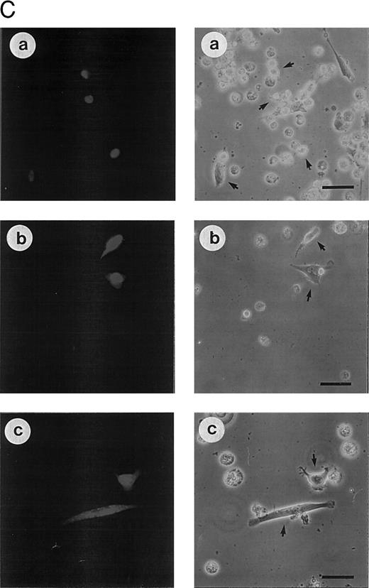 Fig. 3. Effects of CrmA and antisense cDNA constructs complementary to single ICE proteases on apoptosis. (A) Inhibition of apoptosis in MG63 cells by cDNA microinjection. Cells (8 × 105) were seeded in 60-mm tissue dishes. After overnight incubation, cell nuclei were microinjected with a CrmA expression plasmid or antisense constructs targeting ICH-1, ICE, or CPP32. Cell injections were performed with an automatic microinjection system equipped with glass micropipettes loaded with DNA and Texas red-labeled dextran. After 20 hours after microinjection, cells were treated with anti–APO-1, CR, DX, or MT as described in Fig 1 and incubated for a further 48 hours. Anti–APO-1 treatment was applied in the presence of 5 μg/mL cycloheximide, which was not toxic by itself. Cells were fixed with 2.5% glutaraldehyde and inspected microscopically. Microinjected cells were identified by red fluorescent staining. Cells were regarded as apoptotic when they showed membrane blebbing and/or a condensed cell nucleus. At least 180 cells were analyzed for each condition. The values represent the mean ± SD from three independent experiments. (B) Effect of cDNA expression after electroporation of CEM cells. Cells (2 × 108) were transfected the antisense constructs using an electroporator (975 μF, 230 V). After electroporation, cells were seeded at 1 × 106 cells/well in 6-well plates. Eight hours later, cells were treated with G-418 to deplete untransfected cells. Dead cells were removed after a further 36 hours by a washing step in a Ficoll-Paque gradient. The enriched population containing 65% to 88% of transfected cells was then treated with anti–APO-1 for 4 hours or with CR, DX, or MT at the concentrations indicated in Fig 1 for 20 hours. Apoptosis was measured by propidium iodide/Hoechst 33342 uptake using flow cytometry. Data are given as the mean percentage of cell death from four experiments with duplicate samples. / (C) Morphologic analysis of doxorubicin-induced apoptosis after microinjection of CrmA cDNA and antisense constructs complementary to ICE family members in SHEP cells. Cells were microinjected as described in (A) using 0.2% Texas red-dextran together with cDNA constructs encoding (a) empty pCDNA-3 vector, (b) pSV25S-CrmA, (c) antisense ICE, and (d) antisense CPP32. Eight hours after transfection, cells were treated with anti–APO-1, CR, DX, and MT and evaluated 30 hours later by two independent scientists. Microinjected cells were identified by red fluorescent staining (left panel) and are indicated by arrows (right panel). The scale bar represents 20 μm. Quantitative values of specific inhibition after scoring of about 300 cells were 58% for CrmA, 62% for pCDNA-3-a300h.ICE, 61% for pCDNA-3-a300h.CPP32, and 64% for the mixture of ICE and CPP32 antisense constructs microinjected together. / (D) Long-term protection from drug-induced apoptosis by antisense constructs. CEM cells were transfected with empty vector, antisense ICE, or CPP32 constructs and selected in G418-containing medium for 36 hours. Cells were then treated with the indicated cytotoxic drugs. After 30 hours, cells were harvested and limiting dilutions (1:3) were performed, starting from 3 × 104 cells per well. Cell viability was assayed by trypan blue exclusion after 14 days. The highest dilutions still containing living cells are indicated. Samples of cells transfected with control vector did not contain living cells after 14 days of drug treatment; therefore, the vector alone bar is not included. Control indicates the clonogenicity of vector-transfected cells without drug treatment. The data represent experiments with quadruplicated samples. Standard deviations were in the range of one dilution step.
