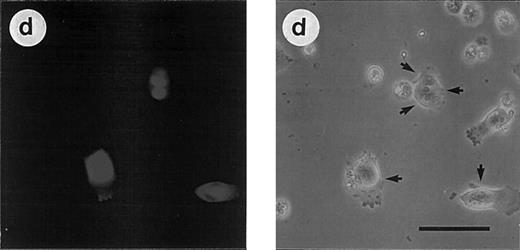 Fig. 3. Effects of CrmA and antisense cDNA constructs complementary to single ICE proteases on apoptosis. (A) Inhibition of apoptosis in MG63 cells by cDNA microinjection. Cells (8 × 105) were seeded in 60-mm tissue dishes. After overnight incubation, cell nuclei were microinjected with a CrmA expression plasmid or antisense constructs targeting ICH-1, ICE, or CPP32. Cell injections were performed with an automatic microinjection system equipped with glass micropipettes loaded with DNA and Texas red-labeled dextran. After 20 hours after microinjection, cells were treated with anti–APO-1, CR, DX, or MT as described in Fig 1 and incubated for a further 48 hours. Anti–APO-1 treatment was applied in the presence of 5 μg/mL cycloheximide, which was not toxic by itself. Cells were fixed with 2.5% glutaraldehyde and inspected microscopically. Microinjected cells were identified by red fluorescent staining. Cells were regarded as apoptotic when they showed membrane blebbing and/or a condensed cell nucleus. At least 180 cells were analyzed for each condition. The values represent the mean ± SD from three independent experiments. (B) Effect of cDNA expression after electroporation of CEM cells. Cells (2 × 108) were transfected the antisense constructs using an electroporator (975 μF, 230 V). After electroporation, cells were seeded at 1 × 106 cells/well in 6-well plates. Eight hours later, cells were treated with G-418 to deplete untransfected cells. Dead cells were removed after a further 36 hours by a washing step in a Ficoll-Paque gradient. The enriched population containing 65% to 88% of transfected cells was then treated with anti–APO-1 for 4 hours or with CR, DX, or MT at the concentrations indicated in Fig 1 for 20 hours. Apoptosis was measured by propidium iodide/Hoechst 33342 uptake using flow cytometry. Data are given as the mean percentage of cell death from four experiments with duplicate samples. / (C) Morphologic analysis of doxorubicin-induced apoptosis after microinjection of CrmA cDNA and antisense constructs complementary to ICE family members in SHEP cells. Cells were microinjected as described in (A) using 0.2% Texas red-dextran together with cDNA constructs encoding (a) empty pCDNA-3 vector, (b) pSV25S-CrmA, (c) antisense ICE, and (d) antisense CPP32. Eight hours after transfection, cells were treated with anti–APO-1, CR, DX, and MT and evaluated 30 hours later by two independent scientists. Microinjected cells were identified by red fluorescent staining (left panel) and are indicated by arrows (right panel). The scale bar represents 20 μm. Quantitative values of specific inhibition after scoring of about 300 cells were 58% for CrmA, 62% for pCDNA-3-a300h.ICE, 61% for pCDNA-3-a300h.CPP32, and 64% for the mixture of ICE and CPP32 antisense constructs microinjected together. / (D) Long-term protection from drug-induced apoptosis by antisense constructs. CEM cells were transfected with empty vector, antisense ICE, or CPP32 constructs and selected in G418-containing medium for 36 hours. Cells were then treated with the indicated cytotoxic drugs. After 30 hours, cells were harvested and limiting dilutions (1:3) were performed, starting from 3 × 104 cells per well. Cell viability was assayed by trypan blue exclusion after 14 days. The highest dilutions still containing living cells are indicated. Samples of cells transfected with control vector did not contain living cells after 14 days of drug treatment; therefore, the vector alone bar is not included. Control indicates the clonogenicity of vector-transfected cells without drug treatment. The data represent experiments with quadruplicated samples. Standard deviations were in the range of one dilution step.