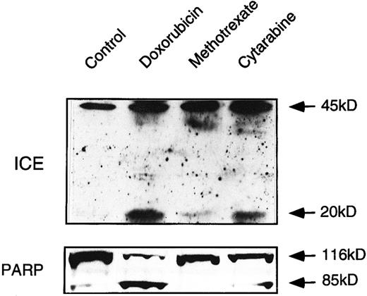 Fig. 7. ICE processing and PARP cleavage in ex vivo-derived leukemia cells. Extracts obtained from cells treated with the indicated cytotoxic drugs were processed as described in methodology and analyzed by immunoblotting for ICE processing and PARP cleavage. Mononuclear cells containing more than 95% of leukemia blasts were separated from whole heparinized blood by Ficoll-Paque gradient centrifugation. Because of the shortage of patient material, the experiment has been performed once only.