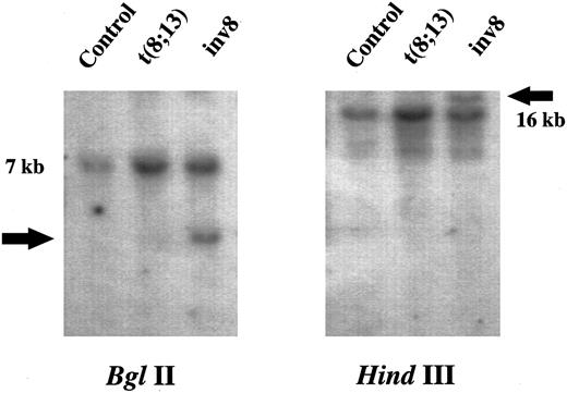 Fig. 4. Southern blot of DNA from a control (CML patient without an 8p11 abnormality), UPN 03 and UPN 04 probed with MOZ 0.9. Restriction endonucleases used are indicated. Germline and rearranged bands are indicated by size and an arrow, respectively.