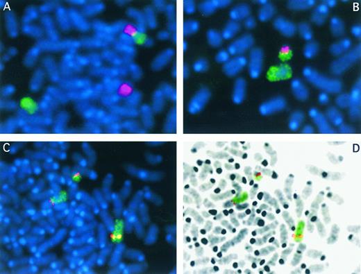 Fig. 1. FISH analysis of the t(8; 13) chromosome translocation from R.B. Somatic cell hybrids RBF1 (A) and RBF24 (B) were stained with DAPI (blue) in each case. Partial metaphase spreads are shown in each case after chromosome painting. The green signal represents chromosome 8 material, and the red signal is from chromosome 13. In RBF1 (A), the der(8) can be clearly seen (top), as can the normal copies of chromosomes 8 (green) and 13 (red). In hybrid RBF1 (B), only the normal 8 is seen, as well as the der(13). When YAC 959A4 from chromosome 8 is hybridized to cells from RBF1 (C) and then cells are identified that contain both of the derivative chromosomes, the hybridization signal from the YAC is seen (red) on the normal copy of chromosome 8 (bottom right), as well as the 2 derivative chromosomes (top left). In these cells, chromosome 8 material is painted green. The DAPI image from the partial metaphase chromosome spread shown in C has been processed in D to reveal the typical G-band appearance of the chromosomes. The derivative chromosomes therefore can be clearly identified. The red and green signals have been superimposed on this black and white image.