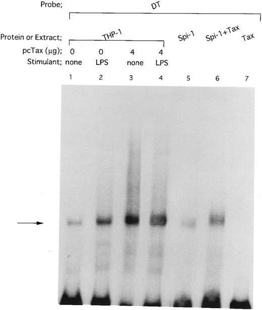 Fig. 4. HTLV-I Tax induces binding of Spi-1 to the IL1B promoter. The −59 to +12 DT fragment was used as a radiolabeled probe. Nuclear extracts were prepared from THP-1 cells carrying either pcTax (4 μg; lanes 3 and 4) or control pcDNA1 vector (4 μg; lanes 1 and 2). THP-1 cells were transfected with either pcTax or pcDNA1. At 24 hours after transfection, cells were treated with 100 ng/mL of LPS for 45 minutes (lanes 2 and 4) or left untreated (lanes 1 and 3). In vitro expressed recombinant Spi-1 was incubated with the radiolabeled DT probe in the presence (lane 6) or absence (lane 5) of in vitro expressed recombinant Tax. The total amount of added reticulocyte lysate in each reaction mixture was kept constant by the addition of incubated control lysate. The arrow locates the mobility of Spi-1.