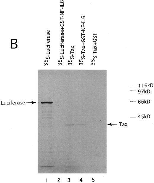 Fig. 8. HTLV-I Tax physically interacts with both Spi-1 (A) and NF-IL6 (B). 35S-labeled Tax and luciferase proteins were prepared by in vitro transcription and translation. Lanes 1 and 3 of experiments A and B indicated the mobilities of these radiolabeled proteins on SDS-PAGE. In lanes 2, 4, and 5 of A and B, labeled proteins were incubated with GST, GST-Spi-1, or GST-NF-IL6 protein linked to glutathione-agarose beads. After incubation, the beads were washed, and bound proteins were eluted. The eluted proteins were analyzed on SDS-PAGE.
