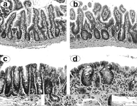 Fig. 6. High TBI doses increase the severity of early GI tract GVHD. Bowel histology in allografted mice treated with 900 cGy TBI (a and c) and 1,300 cGy TBI (b and d). The small bowel of the 900 cGy mouse (a) exhibits mild villous blunting and crypt regenerative changes; crypts in the large bowel (c) exhibit mitotic figures and a rare apoptotic cell (arrowhead). In contrast, small bowel of the 1,300 cGy mouse (b) exhibits more marked villous blunting and crypt regeneration with mitotic figures. The large bowel (d) exhibits crypt atrophy, abundant apoptotic cells (arrowhead), and marked depletion of surface epithelial mucous. Original magnification: (a and b) × 200; (c and d) × 400.
