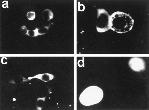 Fig. 2. Fluorescence microscopy of 293-EBNA cells stably expressing FAA-GFP or GFP. (a through c) The images obtained with FAA-GFP. The distribution of GFP is depicted in (d). (b and d) A twofold magnification of the originally recorded image.