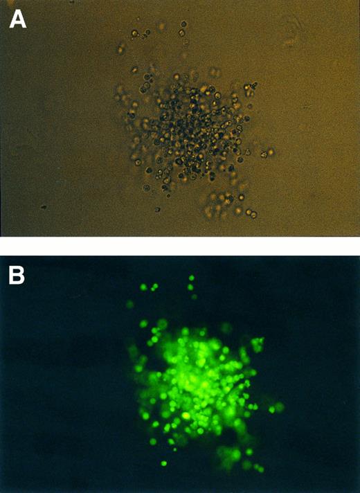 Fig. 4. Transduced CFU-GM under normal (A) and UV light (B) (400× optical magnification).