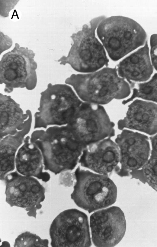Fig. 2. Morphology of PLB-985 cells (A) before treatment and after a 4-day treatment with (B) 1.25% DMSO (differentiation) or (C) 10−7 mol/L 9-cis-RA (apoptosis) (original magnification × 1,000).