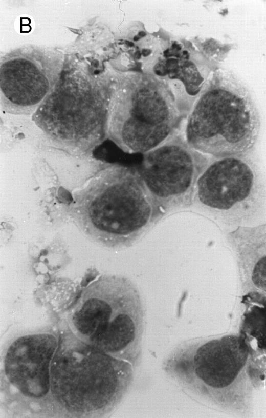 Fig. 2. Morphology of PLB-985 cells (A) before treatment and after a 4-day treatment with (B) 1.25% DMSO (differentiation) or (C) 10−7 mol/L 9-cis-RA (apoptosis) (original magnification × 1,000).