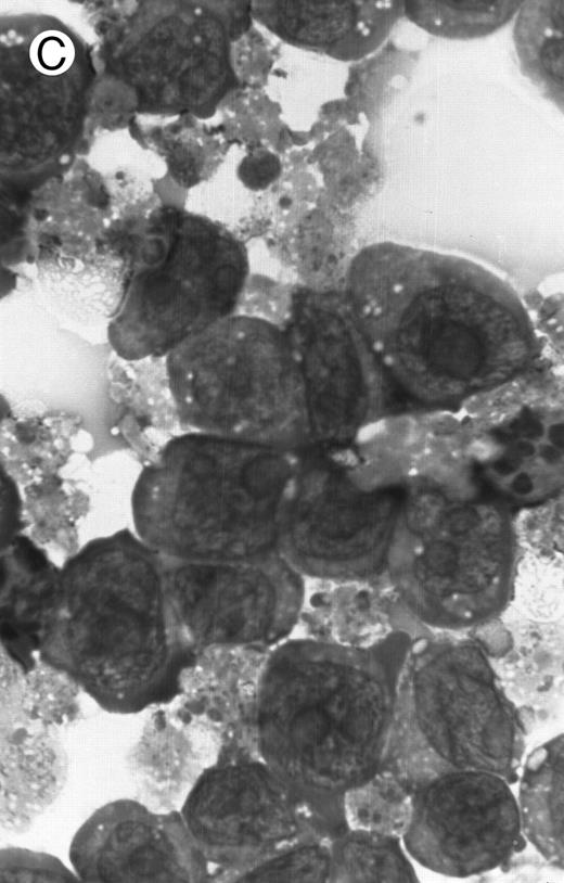 Fig. 2. Morphology of PLB-985 cells (A) before treatment and after a 4-day treatment with (B) 1.25% DMSO (differentiation) or (C) 10−7 mol/L 9-cis-RA (apoptosis) (original magnification × 1,000).