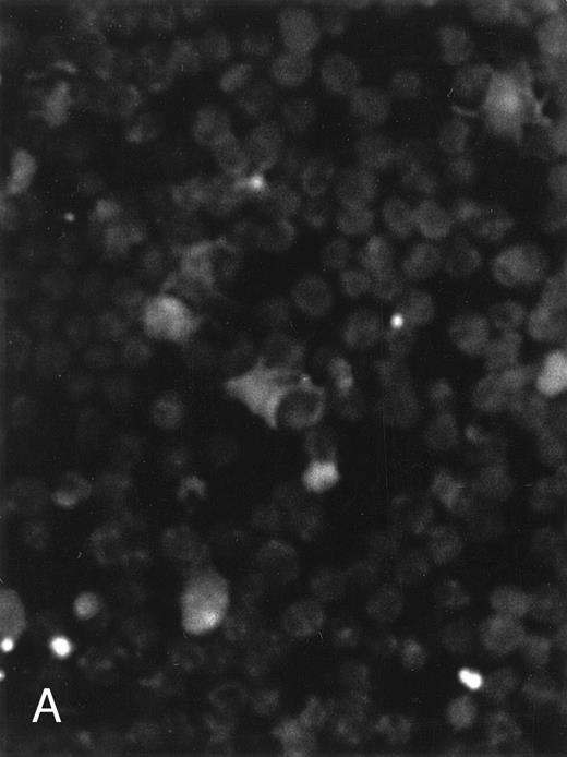 Fig. 4. Induction of genomic DNA-nicking in apoptotic PLB-985 cells treated with 10−6 mol/L 9-cis-RA for 3 days. Cytospins were prepared from (A) normal and (B) RA-treated cells, and the TUNEL assay was performed, labeling the apoptosis-specific DNA strand breaks with fluorescent label as described in Materials and Methods.