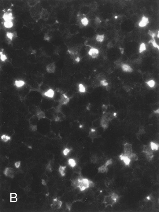 Fig. 4. Induction of genomic DNA-nicking in apoptotic PLB-985 cells treated with 10−6 mol/L 9-cis-RA for 3 days. Cytospins were prepared from (A) normal and (B) RA-treated cells, and the TUNEL assay was performed, labeling the apoptosis-specific DNA strand breaks with fluorescent label as described in Materials and Methods.
