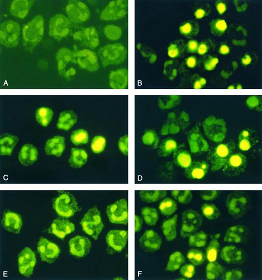 Fig. 2. Morphological features of neutrophil apoptosis. Cytospin preparations of neutrophils from healthy volunteers (A through D) and from patients with severe sepsis (E and F) were treated with TUNEL method after 0 hours (A and E) and 16 hours of incubation (B and F). In addition, neutrophils of healthy humans were incubated with LPS (1 μg/mL) or coincubated with LPS and rhIL-10 (100 U/mL) (C and D). The typical morphologic changes of apoptosis consist of diminution in cell volume and chromatin condensation yielding fragmented or bright homogeneously FITC-stained nuclei. Original magnification of the figures: × 1,000. The figures are representative of five other experiments that yielded the same results.