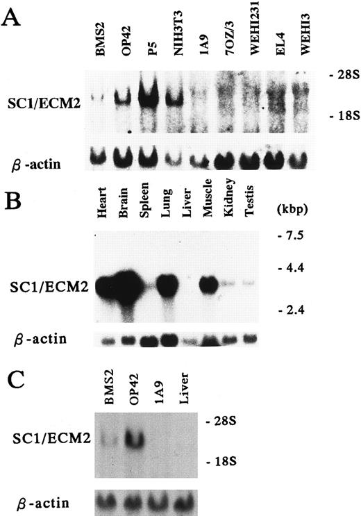 Fig. 3. Expression of SC1/ECM2 in various cells and tissues. (A and C) Total RNA (15 μg/lane) and (B) Poly(A)+ RNA (2 μg/lane) were isolated from the indicated cell lines and tissues, and subjected to Northern blot analysis. The lower panel is a control for equal loading where the same blot was probed with β-actin.