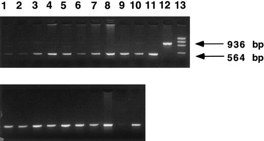 Fig. 2. β IVS-2 PCR of transduced mouse spleen colonies. Two recipient mice were killed 12 days after transplantation with human β-globin transduced marrow. DNA samples were obtained from individual spleen colonies and PCR analysis performed using primers specific for the β-globin IVS-2 region (upper panel). Lanes 1 through 10, samples from individual spleen colonies; lane 11, producer cell DNA; lane 12, normal human DNA; lane 13, a size marker, φX. Indicated on the right of the figure are the predicted PCR bands for normal human β-globin (936 bp) and vector-derived human β-globin which contains a 372-bp deletion in IVS-2 (564 bp). Eight of 10 spleen colonies are strongly PCR-positive, the other two are weakly positive. As a control for DNA loading, PCR analysis using PDGF B primers was performed on each CFU-S sample as described in Materials and Methods (lower panel). DNA loading was approximately equal, except for the sample in lane 9.