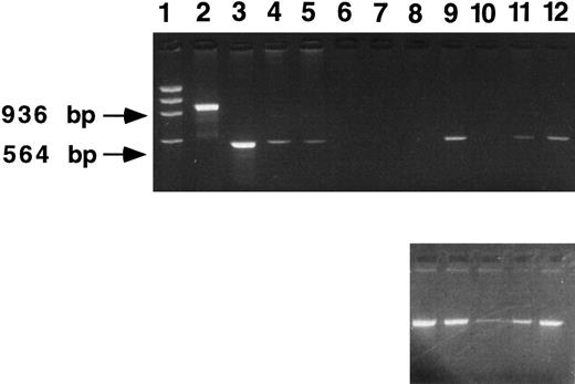 Fig. 3. β IVS-2 PCR of 5-month peripheral blood samples. DNA samples were obtained from mice transplanted with human β-globin transduced marrow (β-mice) and from mice transplanted with neomycin resistance gene-transduced marrow (neoR mice). PCR analysis was performed using primers specific for the β-globin IVS-2 region (upper panel). Lane 1, a size marker (φX); lane 2, a normal human DNA sample; lanes 3 through 5 represent dilutions of producer cell DNA (lane 3, 100%; lane 4, 10%, lane 5, 1%); lanes 6 and 7, samples from two neoR mice; and lanes 8 through 12, samples from β-mice. Indicated at the left of the figure are the predicted PCR bands for human β-globin (936 bp) and vector-derived human β-globin (564 bp). Three of 5 mice (lanes 9, 11, and 12) are positive. As a control for DNA loading, PCR analysis using PDGF B primers was performed on each sample as described in Materials and Methods (lower panel). Apart from lane 10, DNA loading was approximately equal.