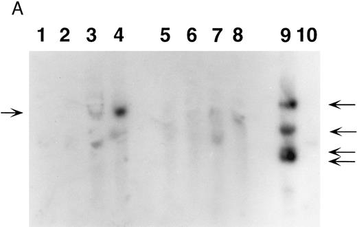 Fig. 4. Southern blot analysis of mouse marrow. DNA obtained from marrow and spleens of experiment 1 mice was digested with Xba I (A) and Sac I (B) and probed with a neoR probe as described in Materials and Methods. In both figures, lanes 1 through 4 represent DNA samples obtained from BM of mice 1 through 4; lanes 5 through 8, DNA samples from corresponding spleens; lane 9, producer cell DNA; lane 10, DNA from normal mouse spleen. Mice 1 and 2 show no evidence of human β-globin gene expression while mice 3 and 4 do (Fig 5, Table 3). (A). The retroviral vector p141 contains a single Xba I restriction site, and this digest was used to determine the number of chromosomal integration sites. The arrows on the right indicate the four integration sites seen in the producer cells in lane 9. In mice 1 and 2, no significant bands are seen; mouse 3 has at least two integration sites, while mouse 4 has a single dominant integration site (indicated by the arrow on the left). (B). The LTR regions of p141 each contain an Sac I site, and this digest was used to determine the integrity of the transferred β-globin gene. Producer cells contain three intact copies and one truncated copy of the retroviral vector (intensity of 5.1-kb band is three times that of the lower band in lane 9). Mice 1 and 2 have no detectable provirus in BM, while mice 3 and 4 both have the intact 5.1-kb human β-globin gene-containing provirus (lanes 1 through 4). Twice as much DNA (10 μg) of spleen and marrow samples was loaded as was producer cell DNA (5 μg). By comparing the intensities of the single and the three copy bands from the producer line in lane 9 with those of the 5.1-kb bands in mice 3 and 4 (lanes 3 and 4) by phosphorimaging, we calculate that there are 0.53 and 0.64 copies of the human β-globin gene per cell in the marrow cells of these mice. The intense signal in spleen DNA in lane 5 of (B) is caused by contamination, and is not seen on repeat Southern blot analysis.