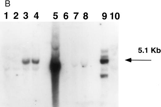 Fig. 4. Southern blot analysis of mouse marrow. DNA obtained from marrow and spleens of experiment 1 mice was digested with Xba I (A) and Sac I (B) and probed with a neoR probe as described in Materials and Methods. In both figures, lanes 1 through 4 represent DNA samples obtained from BM of mice 1 through 4; lanes 5 through 8, DNA samples from corresponding spleens; lane 9, producer cell DNA; lane 10, DNA from normal mouse spleen. Mice 1 and 2 show no evidence of human β-globin gene expression while mice 3 and 4 do (Fig 5, Table 3). (A). The retroviral vector p141 contains a single Xba I restriction site, and this digest was used to determine the number of chromosomal integration sites. The arrows on the right indicate the four integration sites seen in the producer cells in lane 9. In mice 1 and 2, no significant bands are seen; mouse 3 has at least two integration sites, while mouse 4 has a single dominant integration site (indicated by the arrow on the left). (B). The LTR regions of p141 each contain an Sac I site, and this digest was used to determine the integrity of the transferred β-globin gene. Producer cells contain three intact copies and one truncated copy of the retroviral vector (intensity of 5.1-kb band is three times that of the lower band in lane 9). Mice 1 and 2 have no detectable provirus in BM, while mice 3 and 4 both have the intact 5.1-kb human β-globin gene-containing provirus (lanes 1 through 4). Twice as much DNA (10 μg) of spleen and marrow samples was loaded as was producer cell DNA (5 μg). By comparing the intensities of the single and the three copy bands from the producer line in lane 9 with those of the 5.1-kb bands in mice 3 and 4 (lanes 3 and 4) by phosphorimaging, we calculate that there are 0.53 and 0.64 copies of the human β-globin gene per cell in the marrow cells of these mice. The intense signal in spleen DNA in lane 5 of (B) is caused by contamination, and is not seen on repeat Southern blot analysis.