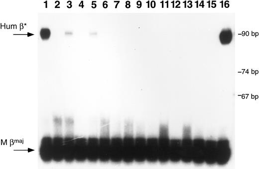 Fig. 5. Primer extension analysis of RNA from peripheral blood samples. RNA samples were obtained from peripheral blood of mice after transplantation with transduced marrow or fetal liver cells. Primer extension analysis was performed using one primer specific for mouse β-globin major and one specific for human β-globin. Lanes 1 through 3 are samples from mice transplanted with β-globin transduced marrow; lanes 4 through 13 represent samples from mice transplanted with β-globin transduced fetal liver cells; lanes 14 and 15 are negative controls and lane 16 represents positive control RNA obtained from a mouse transgenic for multiple copies of the human β-globin gene.24 The arrows at the left of the figure indicate the predicted positions for human β-globin (Hum β) and mouse β-globin (M βmaj). Size markers are noted on the right side of the figure. Positive signals are seen in the mouse blood samples in lanes 1, 3, and 5. The RNA sample in lane 1 is from mouse 4 in Fig 4; the sample in lane 3 is from mouse 3 in Fig 4.