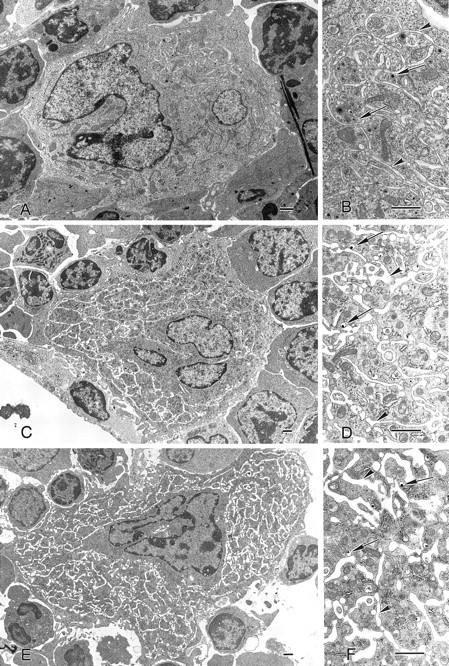Fig. 1. Megakaryocyte ultrastructure. Megakaryocytes from wild-type (A and B), c-mpl-/- (C and D), and TPO-/- (E and F) mice display multilobulated nuclei, and the cytoplasm contains normal α-granules, some of which display dense cores (B, D, and F, arrows). The demarcation membrane system appears normal (arrowheads). Bar = 1 μm.