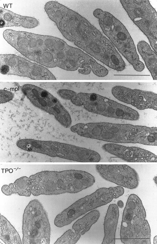 Fig. 2. Platelet ultrastructure. High-magnification micrographs of unactivated circulating platelets from wild-type (WT), c-mpl-/-, and TPO-/- mice show that the cytoplasmic constituents display similar morphologic features including α-granules and marginal bands of microtubules.