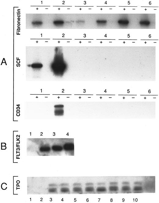 Fig. 6. Southern blot analysis of PCR products from stromal cultures initiated by FACS sorted single cells. (A) RNA was extracted from six fetal bone marrow stromal cultures that had been initiated by CD34+ or CD34− FACS sorted single cells. (+) cDNA was synthesized by the addition of random hexamer primers and reverse transcriptase. (−) The same reaction conditions lacking reverse transcriptase were used. The presence of specific PCR products was detected by Southern blot using a Fibronectin, SCF, CD34 32P-labeled specific probes as indicated. (B) RNA was extracted from 4 unselected stromal cultures of adult bone marrow stromal cells. cDNA was synthesized by the addition of random hexamer primers and reverse transcriptase. The presence of specific PCR products was detected by Southern blot using a FL 32P-labeled internal probe as indicated. (C) RNA was extracted from 10 stromal cultures initiated by FACS sorted single cells with the CD34+ or CD34− phenotype. cDNA was synthesized by the addition of random hexamer primers and reverse transcriptase. The presence of specific PCR products was detected by Southern blot using a TPO specific 32P-labeled internal probe as indicated.