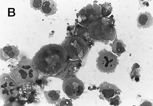 Fig. 3. Morphology of CMK cell cytospins, Wright stained, and photographed at 400×. (A) Parental CMK cells showing an immature phenotype. The majority of cells have a single noncondensed nucleus with a small amount of cytoplasm. (B) Parental CMK cells treated with PMA. The cells show signs of differentiation including increased cell size, increased amount of cytoplasm, increased vacuolation of the cytoplasm, and an increased nuclear density with areas of multinucleation. (C) Vector control transfected CMK clone showing an immature phenotype. (D) WT Mek transfected CMK clone showing an immature phenotype. (E) DE Mek transfected clone showing a differentiated phenotype. (F ) D330N Erk transfected clone showing a differentiated phenotype.