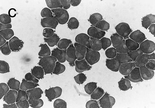 Fig. 3. Morphology of CMK cell cytospins, Wright stained, and photographed at 400×. (A) Parental CMK cells showing an immature phenotype. The majority of cells have a single noncondensed nucleus with a small amount of cytoplasm. (B) Parental CMK cells treated with PMA. The cells show signs of differentiation including increased cell size, increased amount of cytoplasm, increased vacuolation of the cytoplasm, and an increased nuclear density with areas of multinucleation. (C) Vector control transfected CMK clone showing an immature phenotype. (D) WT Mek transfected CMK clone showing an immature phenotype. (E) DE Mek transfected clone showing a differentiated phenotype. (F ) D330N Erk transfected clone showing a differentiated phenotype.