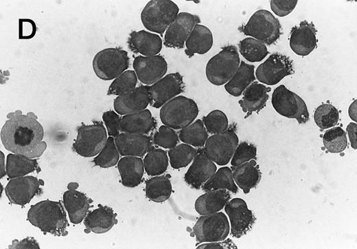 Fig. 3. Morphology of CMK cell cytospins, Wright stained, and photographed at 400×. (A) Parental CMK cells showing an immature phenotype. The majority of cells have a single noncondensed nucleus with a small amount of cytoplasm. (B) Parental CMK cells treated with PMA. The cells show signs of differentiation including increased cell size, increased amount of cytoplasm, increased vacuolation of the cytoplasm, and an increased nuclear density with areas of multinucleation. (C) Vector control transfected CMK clone showing an immature phenotype. (D) WT Mek transfected CMK clone showing an immature phenotype. (E) DE Mek transfected clone showing a differentiated phenotype. (F ) D330N Erk transfected clone showing a differentiated phenotype.
