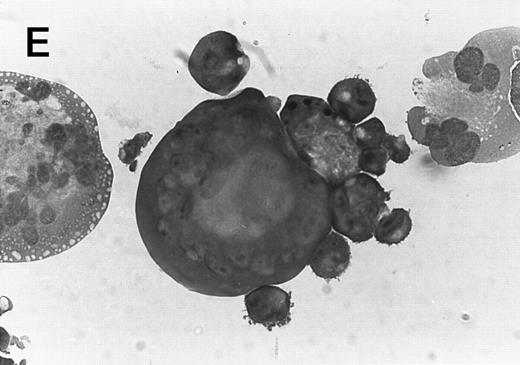 Fig. 3. Morphology of CMK cell cytospins, Wright stained, and photographed at 400×. (A) Parental CMK cells showing an immature phenotype. The majority of cells have a single noncondensed nucleus with a small amount of cytoplasm. (B) Parental CMK cells treated with PMA. The cells show signs of differentiation including increased cell size, increased amount of cytoplasm, increased vacuolation of the cytoplasm, and an increased nuclear density with areas of multinucleation. (C) Vector control transfected CMK clone showing an immature phenotype. (D) WT Mek transfected CMK clone showing an immature phenotype. (E) DE Mek transfected clone showing a differentiated phenotype. (F ) D330N Erk transfected clone showing a differentiated phenotype.