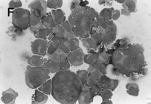Fig. 3. Morphology of CMK cell cytospins, Wright stained, and photographed at 400×. (A) Parental CMK cells showing an immature phenotype. The majority of cells have a single noncondensed nucleus with a small amount of cytoplasm. (B) Parental CMK cells treated with PMA. The cells show signs of differentiation including increased cell size, increased amount of cytoplasm, increased vacuolation of the cytoplasm, and an increased nuclear density with areas of multinucleation. (C) Vector control transfected CMK clone showing an immature phenotype. (D) WT Mek transfected CMK clone showing an immature phenotype. (E) DE Mek transfected clone showing a differentiated phenotype. (F ) D330N Erk transfected clone showing a differentiated phenotype.