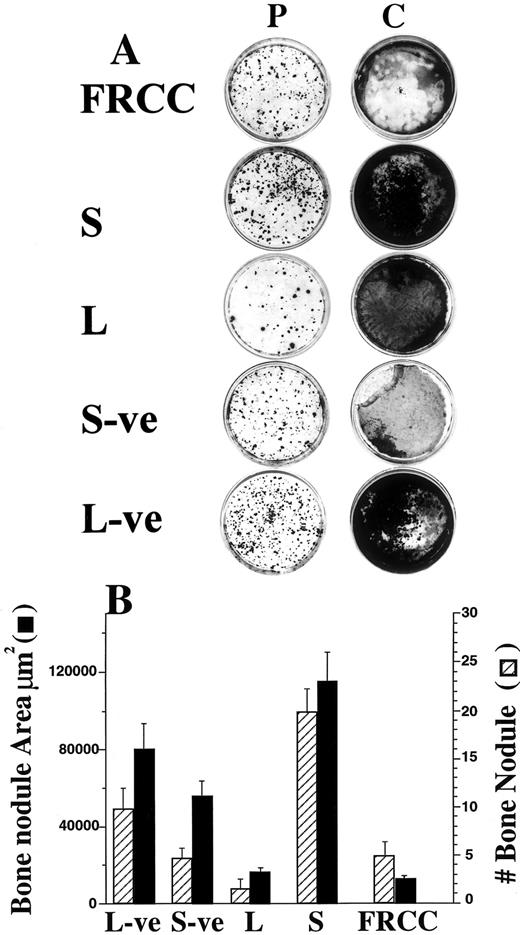 Fig. 4. Analysis of bone nodule formation. (A) Photograph of day 16 cultures stained by Von Kossa to show mineralization. All subpopulations exhibit mineralization when grown on plastic dishes (P) but S and L− cells exhibit larger numbers of bone nodules. Mineralization is observed only for S and L− cells when grown on collagen-coated (C) dishes. (B) Bone nodule number and size (μm) determined after Von Kossa staining of the day 16 cultures grown on plastic dishes (mean ± SEM).