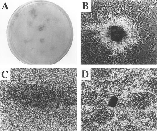 Fig. 5. Evidence for pluripotentiality by formation of multiple cell types at clonal cell densities. Sorted S−cells were plated at very low density (1,000 cells/100-mm diameter plate) and cultured for 45 days (A) × 4 magnification. Note the discrete, isolated colonies distributed througout the dish. Colonies were marked, observed over time, and found to arise from single cells. Colonies were stained for cartilage by alcian blue (B), for adipocytes by oil red (C) and for bone by von Kossa's reagent (D). (B) through (D) × 400 magnification.