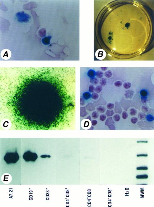 Fig. 4. Integration and expression of the nls-LacZ gene in multilineage cells. (A) The nls-LacZ gene expressing BM cells recovered 4 weeks after injection. Cells with lymphoid (lower right) and myeloid (upper left) morphology are β-gal+. Note the nuclear localization of the β-gal signal. (Original magnification, × 200). (B) Macroscopic view of β-gal+ colonies derived from BM cells recovered 4 weeks after injection. The nls-LacZ expressing HPP-CFC and LPP-CFC are evident in a 60-mm culture dish. (C) Microscopic view of one of the nls-LacZ–expressing HPP-CFC shown in (B). (Original magnification, × 5). (D) The nls-LacZ–expressing thymocytes. Approximately 10% of the cells express nls-LacZ in this sample obtained 8 weeks after injection. (Original magnification, × 200). (E) Southern blot of genomic PCR products from FACS-sorted cell populations. Both CD19+ B cells and CD33+ myeloid cells isolated from a BM 14 weeks after injection (Experiment 11, C2 shown in Table 5) showed strong bands of 470 bp size. In thymocytes recovered 11 weeks after injection, faint bands can be detected in the CD4+CD8+ and CD4+CD8− subsets, but not in the CD4−CD8+ subset. Reanalysis of sorted cells showed a purity of 99.8% for CD19+ cells, 99.5% for CD33+ cells, 99.0% for CD4+CD8+ cells, 99.4% for CD4+CD8− cells, and 98.9% for CD4−CD8+ cells.